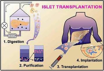 Transplantation2.jpg
